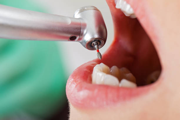 Best Pediatric Emergency Dentist in Lorado Springs, CO